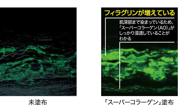 真皮層まで届く Dhcのスーパーコラーゲン